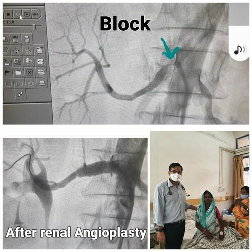 Sometimes need a Stent for the Hypertension|Jamage Heart Centre|Shivaji Road,Miraj
