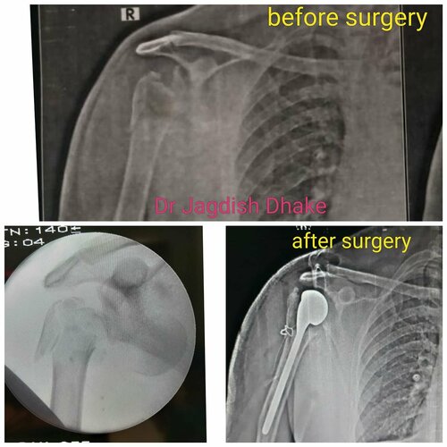 Asperia Clinic & Rahee Hospital|Bibvewadi,Pune