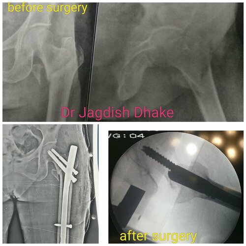 Asperia Clinic & Rahee Hospital|Bibvewadi,Pune