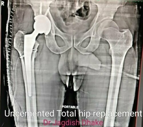 Asperia Clinic & Rahee Hospital|Bibvewadi,Pune