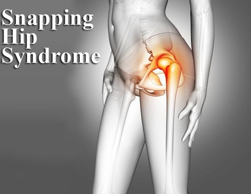 Snapping Hip Syndrome|Dr Nakul Shah|Karve Road ,Pune
