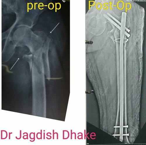 Asperia Clinic & Rahee Hospital|Bibvewadi,Pune