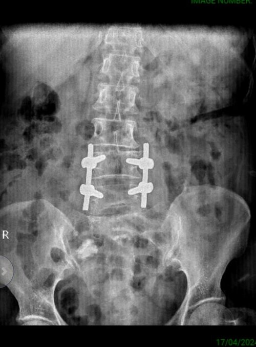 Dr. Soman's Skin and Spine Clinic|Karvenagar,Pune