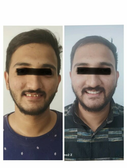 Dr. Gulhane's Urology & Dental Clinic|Hadapsar,Pune