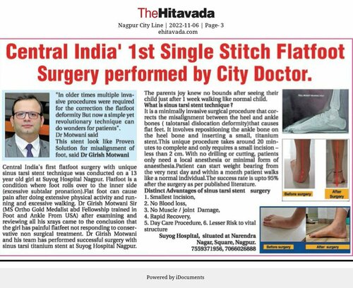 Central India\\\\\\\' 1st Single Stitch Flatfoot Surgery performed by Dr. Girish Motwani|Suyog Hospital|Suyog Nagar,Nagpur