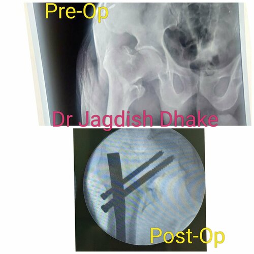 Asperia Clinic & Rahee Hospital|Bibvewadi,Pune