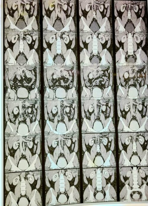 Urozoone Holistic Kidney Care Clinic|Viman Nagar,Pune