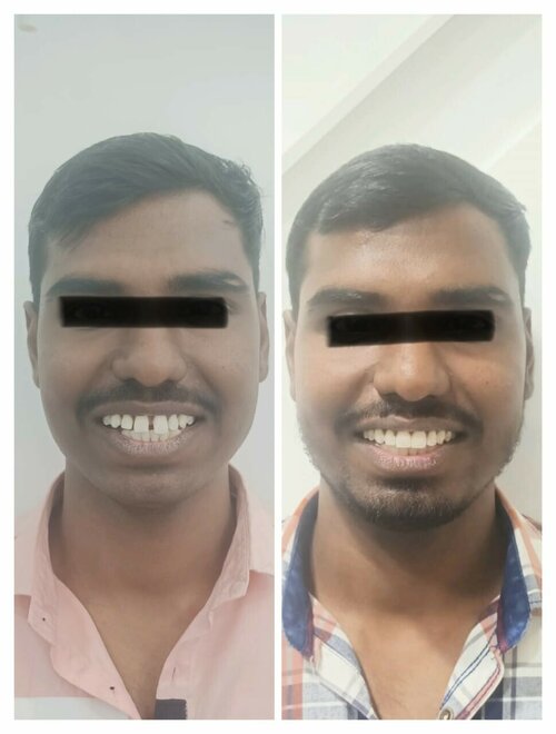 Dr. Gulhane's Urology & Dental Clinic|Hadapsar,Pune