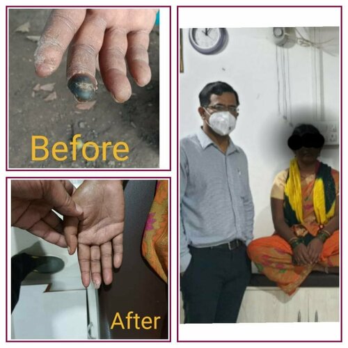 Case study of a Patient - Dr. Yogesh Jamage|Jamage Heart Centre|Shivaji Road,Miraj