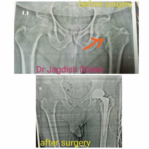 Asperia Clinic & Rahee Hospital|Bibvewadi,Pune