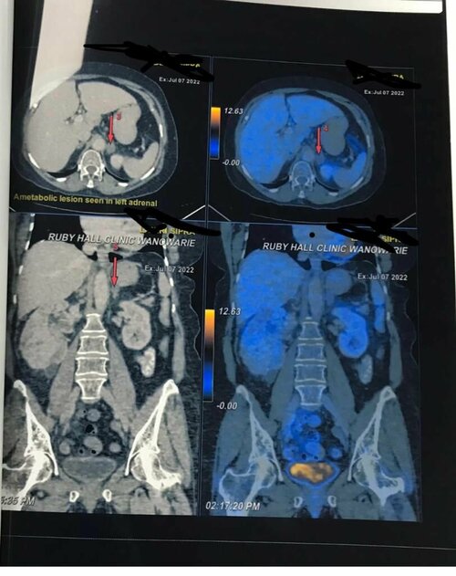 Urozoone Holistic Kidney Care Clinic|Viman Nagar,Pune