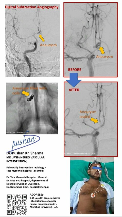 ????????? ??? ???? ??? ???? ???-??? ?????????? ????????? ?????? ????? ?????? ?? ???? | ?? ????? ?????|Medikiran|Rajapur,Prayagraj