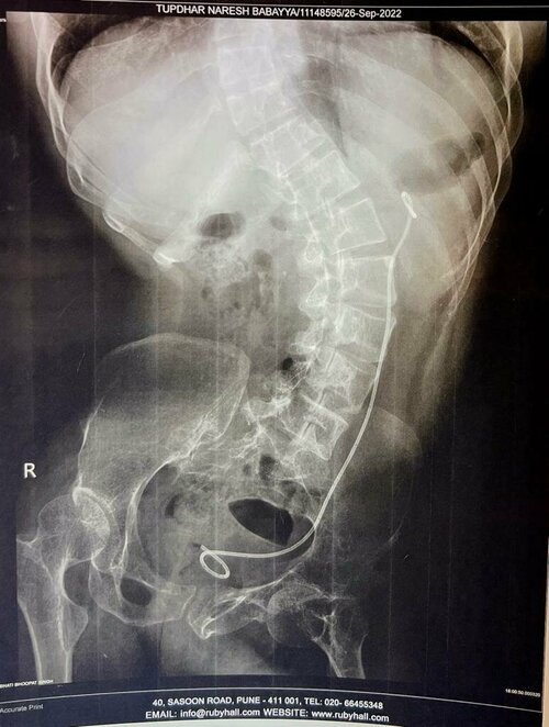 Urozoone Holistic Kidney Care Clinic|Viman Nagar,Pune