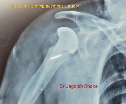 Asperia Clinic & Rahee Hospital|Bibvewadi,Pune