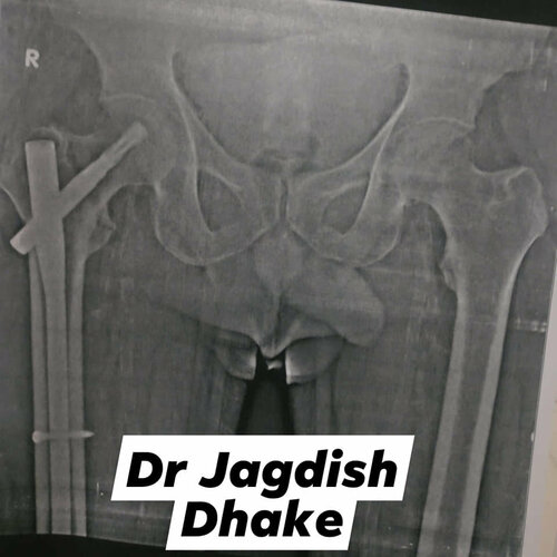 Asperia Clinic & Rahee Hospital|Bibvewadi,Pune