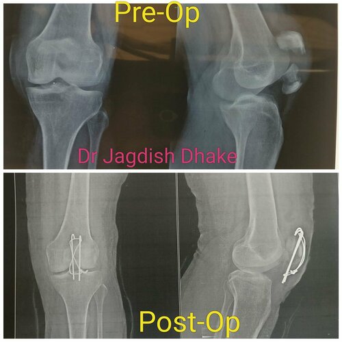 Asperia Clinic & Rahee Hospital|Bibvewadi,Pune