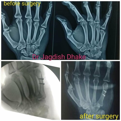 Asperia Clinic & Rahee Hospital|Bibvewadi,Pune