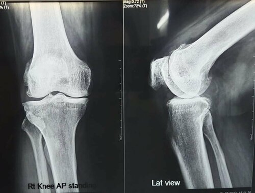 Asperia Clinic & Rahee Hospital|Bibvewadi,Pune