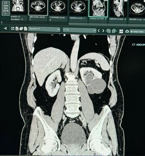 Urozoone Holistic Kidney Care Clinic|Viman Nagar,Pune