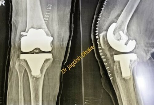 Asperia Clinic & Rahee Hospital|Bibvewadi,Pune