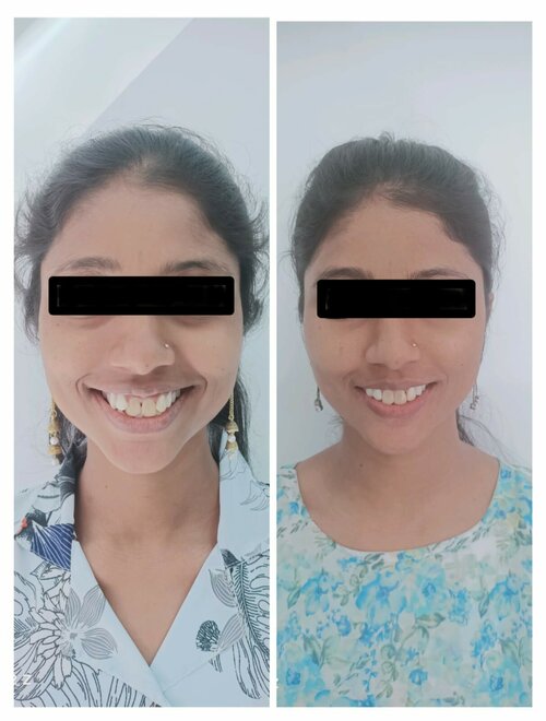 Dr. Gulhane's Urology & Dental Clinic|Hadapsar,Pune