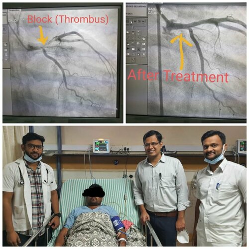 Sometimes Angioplasty is not a solution because Every Life Matters|Jamage Heart Centre|Shivaji Road,Miraj