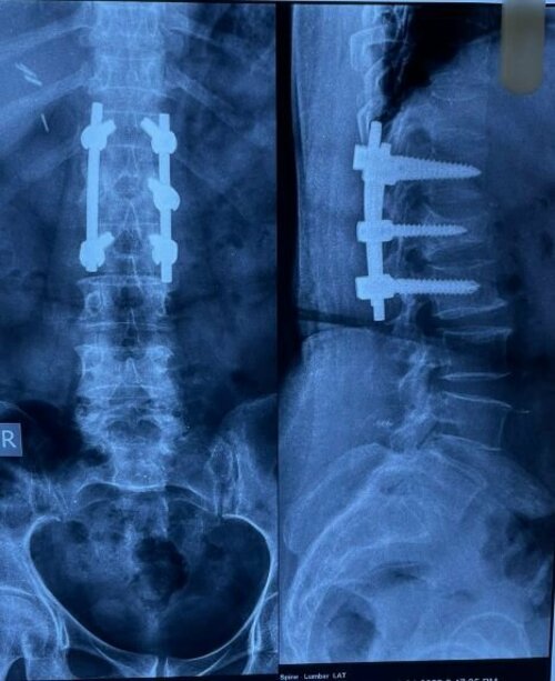 Dr. Sudheer Kumar Pothu|Sanath Nagar,Hyderabad