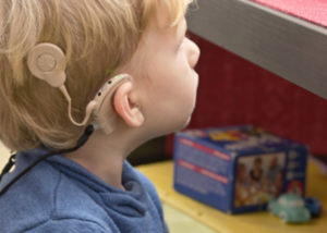 Cochlear Implant Surgery