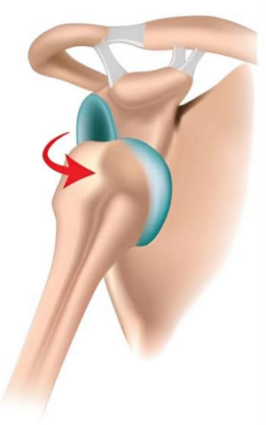 Joint Dislocation Treatment