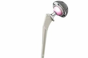 Total hip replacement