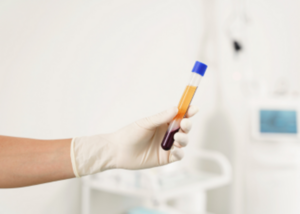 PRP Injections for OA