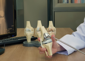 Knee Replacement Surgery