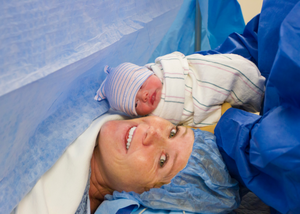C-Section Delivery