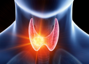 Thyroid Disorders