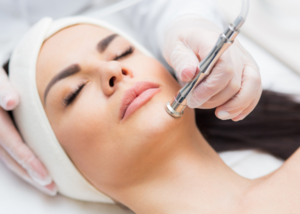 Microdermabrasion