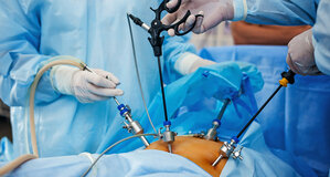 Laparoscopy