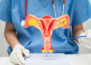 Laparoscopic Myomectomy