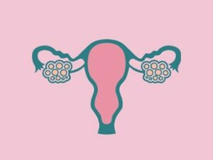 PCOS
