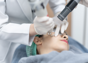 Laser Pigmentation Treatment