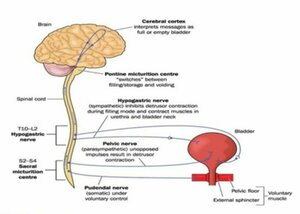 Neurogenic Bladder