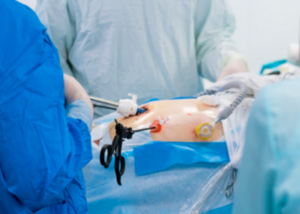 Minimally Invasive Spine Surgery