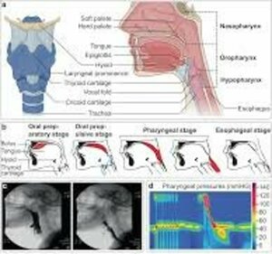 Evaluation of Swallowing Difficulty
