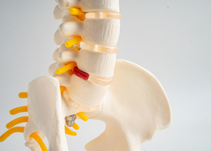 Degenerative Disc Disease Treatment