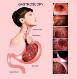 Gastroscopy