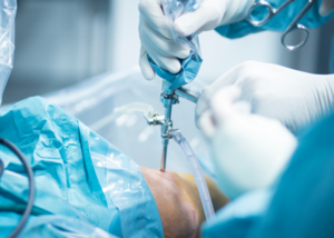 Arthroscopy Surgery in Kondhwa, Pune | Dr. Suhel Khan