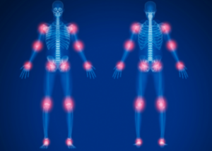 musculoskeletal disorders