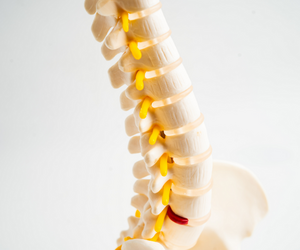 Lumbar Spinal Stenosis