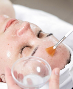 Chemical Peels