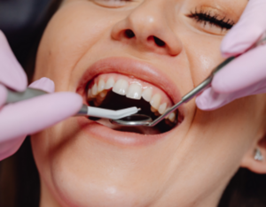 Preventive Dentistry