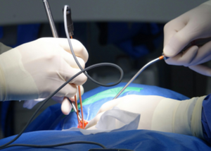 Role of Minimally Invasive Spine Surgery in Modern Orthopedics